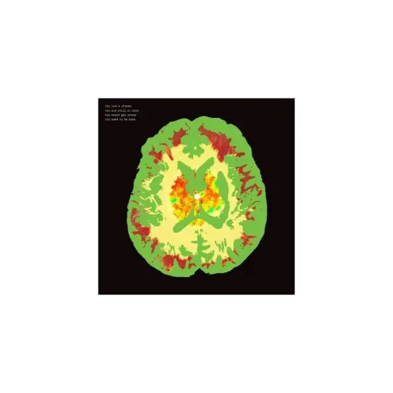 Minus 5, The - Stroke Manor LP (brainwave colored vinyl)