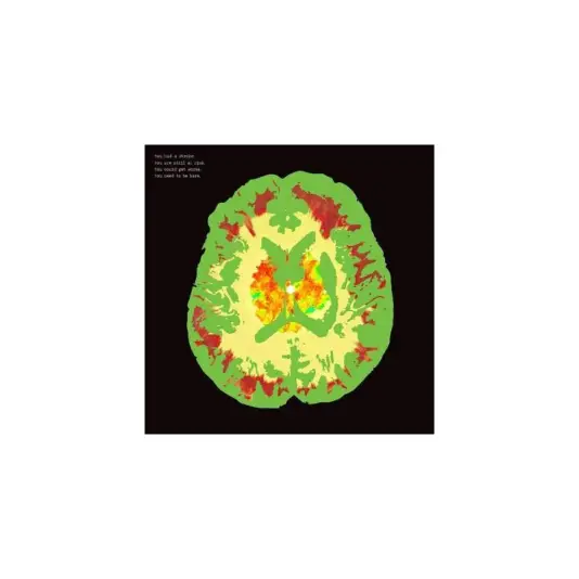 Minus 5, The - Stroke Manor LP (brainwave colored vinyl)